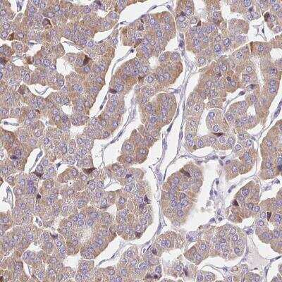 Immunohistochemistry: Guanylyl Cyclase alpha 1 Antibody [NBP2-49210]