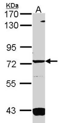 Western Blot: Guanylyl Cyclase alpha 1 Antibody [NBP2-16770]