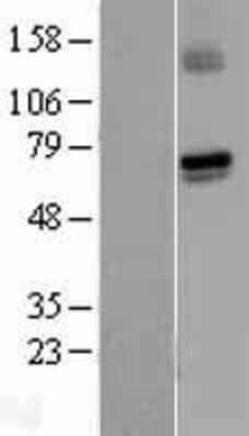 Western Blot: Guanylyl Cyclase alpha 1 Overexpression Lysate [NBL1-11407]