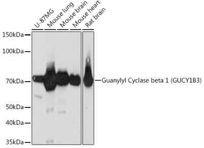 Western Blot: Guanylyl Cyclase beta 1 Antibody (5O8D9) [NBP3-16248]