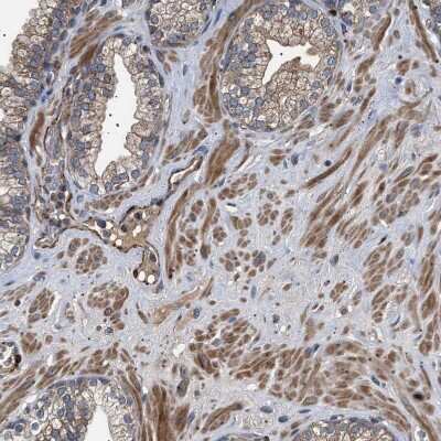 Immunohistochemistry-Paraffin: Guanylyl Cyclase beta 1 Antibody [NBP1-89784]