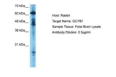 Western Blot: Guanylyl Cyclase beta 1 Antibody [NBP1-58869]