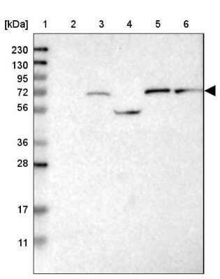 Western Blot: Guanylyl Cyclase beta 1 Antibody [NBP1-89784]