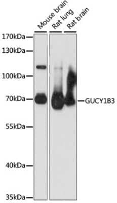 Western Blot: Guanylyl Cyclase beta 1 AntibodyAzide and BSA Free [NBP3-03389]