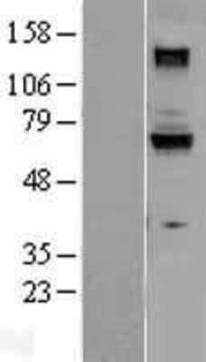 Western Blot: Guanylyl Cyclase beta 1 Overexpression Lysate [NBL1-11408]