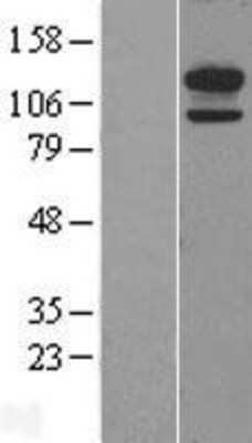 Western Blot: Cadherin-13 Overexpression Lysate [NBL1-09026]