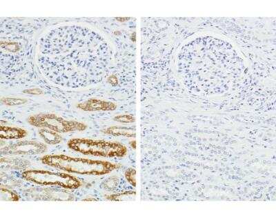 Immunohistochemistry-Paraffin: H.O.H.(TM) (Human on Human) Immunodetection Kit [HOH-3000-NB]