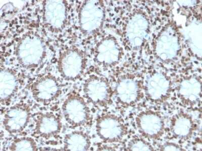 Immunohistochemistry-Paraffin: H1F0 Antibody (AE-4) - Azide and BSA Free [NBP3-08697]