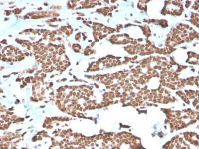 Immunohistochemistry-Paraffin: H1F0 Antibody (AE-4) [NBP3-07712]