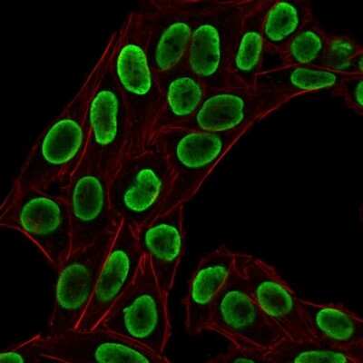 Immunocytochemistry/ Immunofluorescence: H1F0 Antibody (HH1/1784R) [NBP2-53144]
