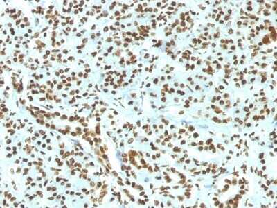 Immunohistochemistry-Paraffin: H1F0 Antibody (HH1/1784R) [NBP2-53144]