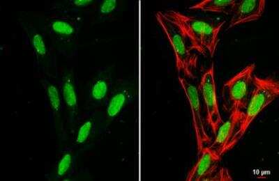 Immunocytochemistry/ Immunofluorescence: H1F0 Antibody [NBP2-16772]