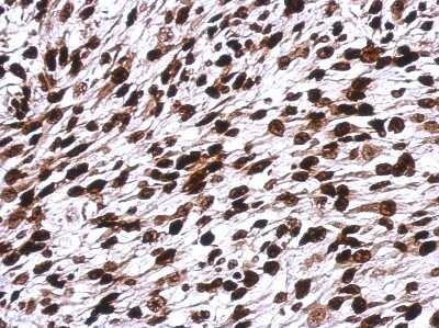 Immunohistochemistry-Paraffin: H1F0 Antibody [NBP2-16772]