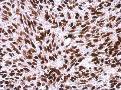 Immunohistochemistry-Paraffin: H1F0 Antibody [NBP2-16772]