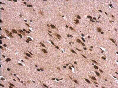 Immunohistochemistry-Paraffin: H1F0 Antibody [NBP2-16772]