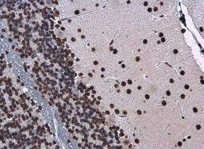 Immunohistochemistry-Paraffin: H1F0 Antibody [NBP2-16772]
