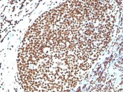 Immunohistochemistry-Paraffin: H1F0 Antibody - Azide and BSA Free [NBP3-08698]