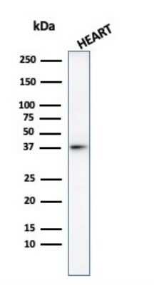 Western Blot: H1F0 Antibody [NBP3-07713]