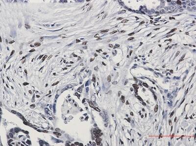 Immunohistochemistry-Paraffin: H1F0 Antibody (S07-0E8) [NBP3-19961]