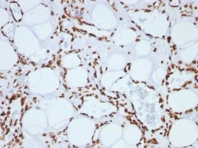 Immunohistochemistry-Paraffin: H1F0 Antibody (SPM256) - IHC-Prediluted [NBP2-48058]