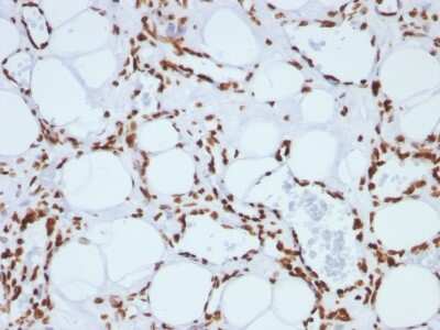 Immunohistochemistry-Paraffin: H1F0 Antibody (SPM256) [NBP2-45183]