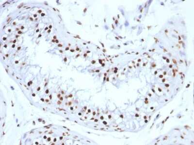 Immunohistochemistry-Paraffin: H1F0 Antibody (SPM256) [NBP2-45183]