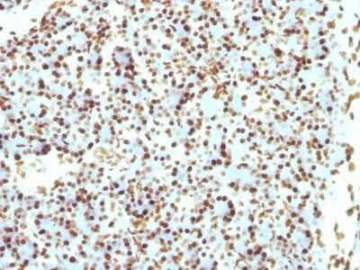 Immunohistochemistry-Paraffin: H1F0 Antibody (r1415-1) - Azide and BSA Free [NBP2-54303]