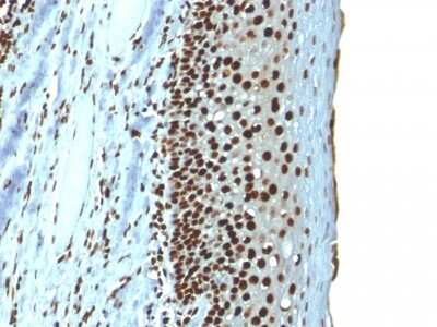 Immunohistochemistry-Paraffin: H1F0 Antibody (r1415-1) [NBP2-53143]
