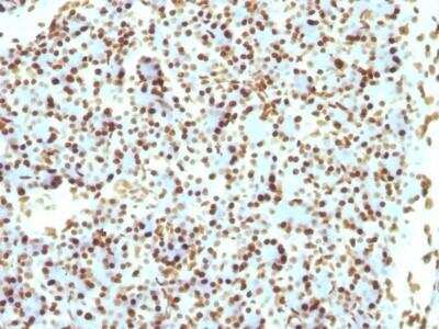 Immunohistochemistry-Paraffin: H1F0 Antibody (r1415-1) [NBP2-53143]