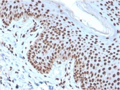 Immunohistochemistry-Paraffin: H1F0 Antibody (rAE-4) [NBP3-07711]
