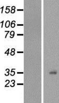 Western Blot: H1F0 Overexpression Lysate [NBP2-07764]