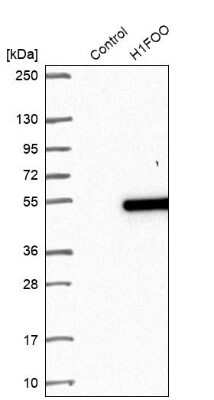 Western Blot: H1FOO Antibody [NBP1-86265]