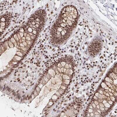 Immunohistochemistry-Paraffin: H1FX Antibody [NBP2-31980]