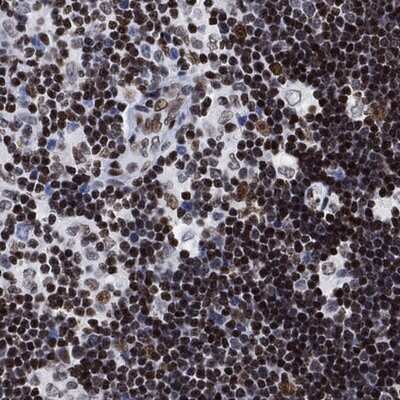 Immunohistochemistry-Paraffin: H1FX Antibody [NBP3-17502]