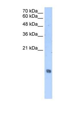 Western Blot: H2A Antibody [NBP1-58095]