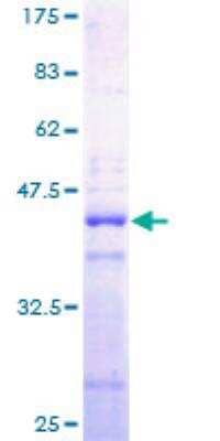 SDS-PAGE: Recombinant Human H2A GST (N-Term) Protein [H00008337-P01]