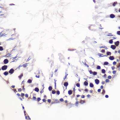 Immunohistochemistry-Paraffin: H2AFV Antibody - Azide and BSA Free [NBP3-04426]