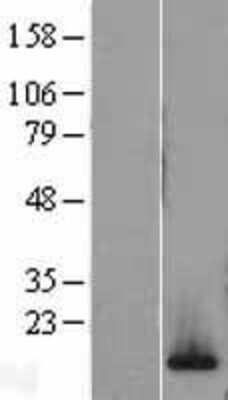 Western Blot: H2AFV Overexpression Lysate [NBL1-11423]