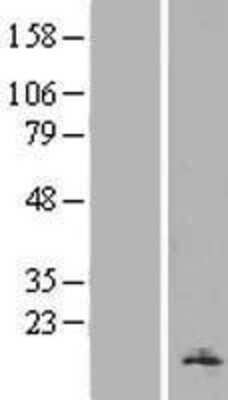 Western Blot: H2AFV Overexpression Lysate [NBP2-05617]