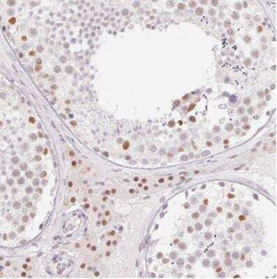 Immunohistochemistry: H2BFWT Antibody [NBP2-30738]