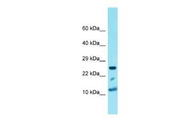 Western Blot: H4 Clustered Histone 1 Antibody [NBP3-09734]