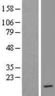 Western Blot: H4/e Overexpression Lysate [NBL1-11570]