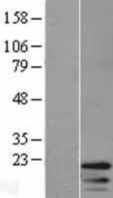 Western Blot: H4/h Overexpression Lysate [NBL1-11568]