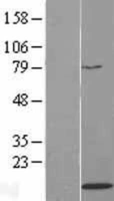 Western Blot: H4/n Overexpression Lysate [NBL1-11574]