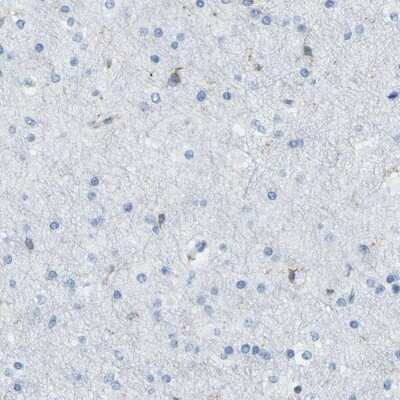 Immunohistochemistry-Paraffin: HA-1 Antibody [NBP1-90107]