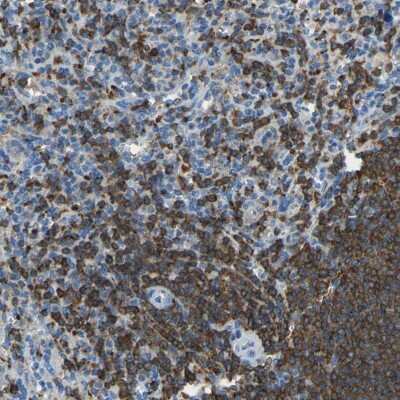 Immunohistochemistry-Paraffin: HA-1 Antibody [NBP1-90107]