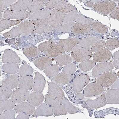 Immunohistochemistry-Paraffin: HA-1 Antibody [NBP3-17053]
