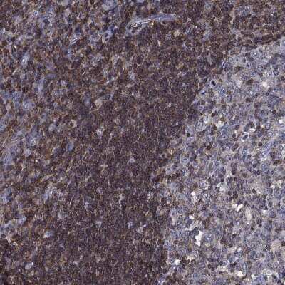 Immunohistochemistry-Paraffin: HA-1 Antibody [NBP3-17053]