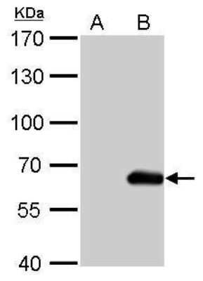 Western Blot: HA Tag Antibody (4810) [NBP2-43714]