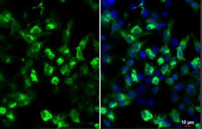 Immunocytochemistry/ Immunofluorescence: HA Tag Antibody (4810) [NBP2-43714]